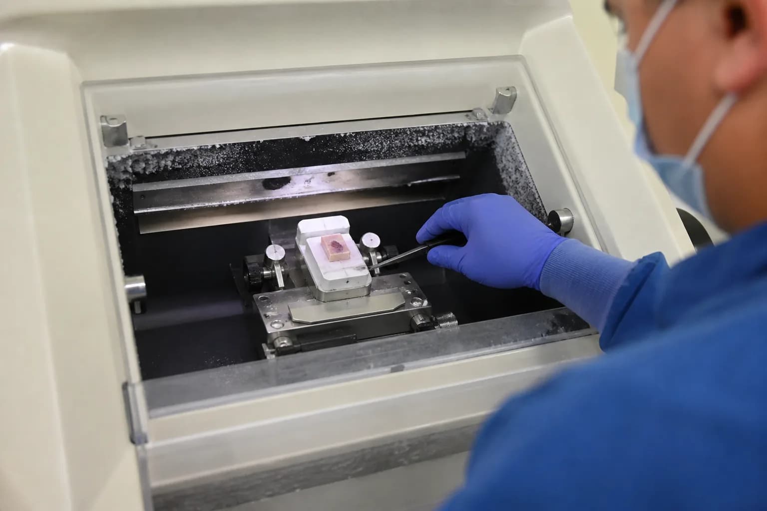 Send-out testing workflow tracking referred specimens and returned results